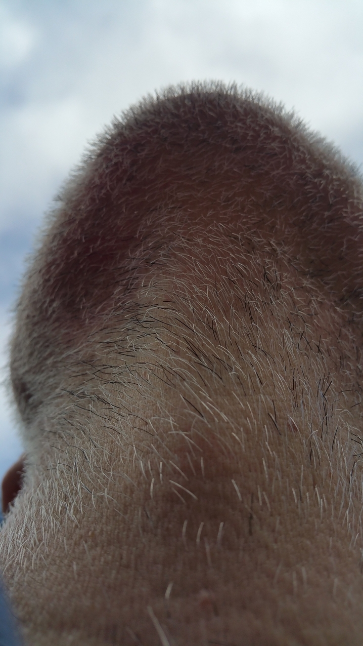 Stachelwatz 2 (ungenießbar)
